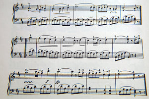 modern-3-piece-aluminium-print-music-notes